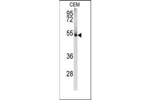 Image no. 1 for anti-Protein Kinase, CAMP-Dependent, Regulatory, Type I, alpha (Tissue Specific Extinguisher 1) (PRKAR1A) (N-Term) antibody (ABIN360569) (PRKAR1A antibody  (N-Term))