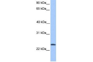 WB Suggested Anti-RP11-269F19. (TCTEX1D4 antibody  (N-Term))