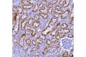 IHC analysis of KMO using anti-KMO antibody (ABIN7600958). (KMO antibody  (AA 26-372))