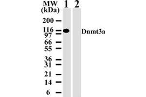 Image no. 1 for anti-DNA (Cytosine-5-)-Methyltransferase 3 alpha (DNMT3A) antibody (ABIN207955) (DNMT3A antibody)