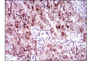 Immunohistochemistry (IHC) image for anti-Fms-Related tyrosine Kinase 3 (FLT3) (AA 930-991) antibody (ABIN1724846)