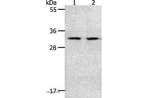 Western blot analysis of Mouse spleen and intestinum crassum tissue, using NME6 Polyclonal Antibody at dilution of 1:400 (NME6 antibody)