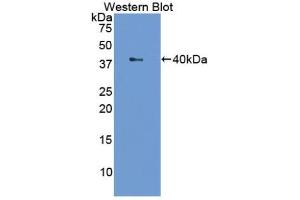 Detection of Recombinant LTF, Cattle using Polyclonal Antibody to Lactoferrin (LTF) (Lactoferrin antibody  (AA 25-352))