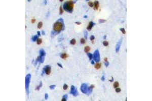 Immunohistochemistry (IHC) image for anti-Transketolase (TKT) antibody (ABIN7308412) (TKT antibody)