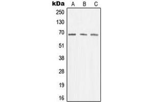 Western blot analysis of Menin expression in K562 (A), Jurkat (B), A431 (C) whole cell lysates. (Menin antibody  (Center))
