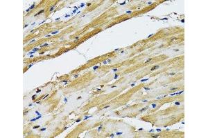 Immunohistochemistry of paraffin-embedded Rat heart using GOT1 Polyclonal Antibody at dilution of 1:100 (40x lens). (GOT1 antibody)