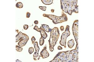 IHC analysis of SRPRA using anti-SRPRA antibody (ABIN7601408). (SRPRA (AA 346-638) antibody)