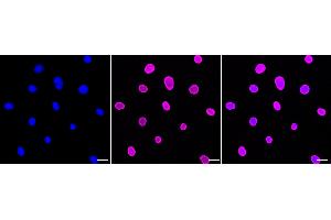 Immunocytochemical staining of C2C12 cells with E2F transcription factor 1 antibody (ABIN7798413), 1:1,000). (Recombinant E2F1 antibody)