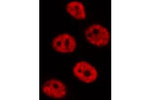 ABIN6272345 staining RAW264. (DUSP4 antibody  (Internal Region))