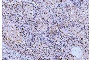 IHC analysis of Cdk2 using anti-Cdk2 antibody (ABIN7602523). (CDK2 antibody  (AA 81-298))