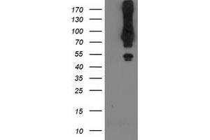Western Blotting (WB) image for anti-Mahogunin, Ring Finger 1 (MGRN1) antibody (ABIN1499459) (Mahogunin RING Finger Protein 1 antibody)