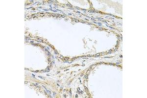 Immunohistochemistry of paraffin-embedded human prostate using TNFRSF10A antibody. (TNFRSF10A antibody  (AA 269-468))