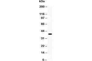 Western blot testing of SIRT3 antibody and recombinant human protein (0. (SIRT3 antibody  (AA 66-399))