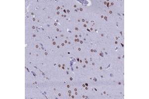 Immunohistochemical staining of human cerebral cortex with FAM169A polyclonal antibody  at 1:200-1:500 dilution. (FAM169A antibody)