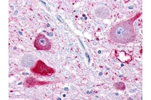 Immunohistochemical staining of Brain (Neurons) using anti- NPFFR1 antibody ABIN122333 (NPFFR1 antibody)