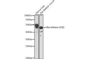 Western blot analysis of extracts of various cell lines, using Glucokinase (Glucokinase (GCK)) antibody (ABIN6131694, ABIN6141012, ABIN6141013 and ABIN6221893) at 1:1000 dilution. (GCK antibody  (AA 1-300))
