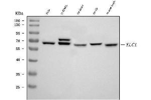 Western blot analysis of KLC1 using anti-KLC1 antibody (ABIN7599468).