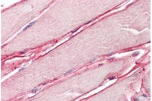 Image no. 2 for anti-Sarcoglycan, delta (35kDa Dystrophin-Associated Glycoprotein) (SGCD) (AA 244-256) antibody (ABIN1496154) (SGCD antibody  (AA 244-256))