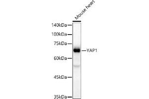 Western blot analysis of extracts of Mouse heart, using Y antibody (ABIN7271418) at 1:20000 dilution. (YAP1 antibody)