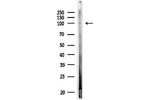 anti-Adenosine Monophosphate Deaminase 2 (AMPD2) (N-Term) antibody