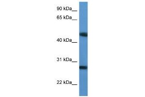 TM2D2 Antikörper  (Middle Region)