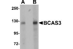 Western Blotting (WB) image for anti-Breast Carcinoma Amplified Sequence 3 (BCAS3) (N-Term) antibody (ABIN1031263) (BCAS3 antibody  (N-Term))