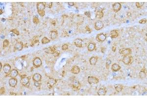Immunohistochemistry (Paraffin-embedded Sections) (IHC (p)) image for anti-Heat Shock Protein 90kDa alpha (Cytosolic), Class A Member 1 (HSP90AA1) antibody (ABIN7256124)