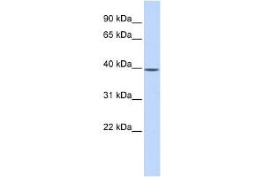 MAT2B antibody used at 1 ug/ml to detect target protein. (MAT2B antibody  (N-Term))