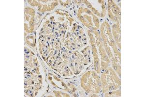 Immunohistochemistry (IHC) image for anti-HUS1 Checkpoint Homolog (S. Pombe) (HUS1) antibody (ABIN1876595) (HUS1 antibody)