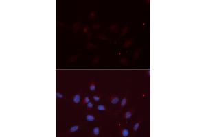 Immunofluorescence (IF) image for anti-Amyloid beta (A4) Precursor-Like Protein 2 (APLP2) antibody (ABIN1876643) (APLP2 antibody)