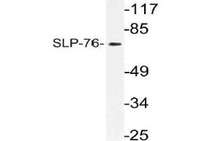 Western blot (WB) analysis of SLP-76 antibody in extracts from Jurkat cells. (LCP2 antibody)