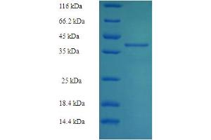 SDS-PAGE (SDS) image for Glutathione S-Transferase alpha 4 (GSTA4) (AA 1-222), (full length) protein (His-SUMO Tag) (ABIN5709617)