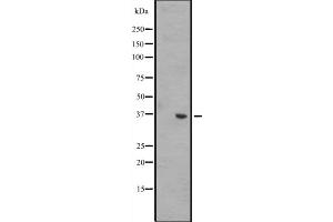 Western blot analysis of WNT8B expression in A431 whole cell lysate ,The lane on the left is treated with the antigen-specific peptide. (WNT8B antibody  (Internal Region))