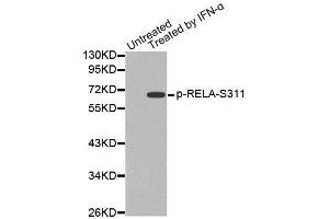 Western blot analysis of extracts from Hela cells, using Phospho-RELA-S311 antibody. (NF-kB p65 antibody  (pSer311))