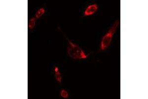 ABIN6275599 staining Hela cells by IF/ICC.