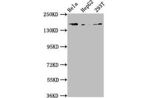 Western Blot Positive WB detected in: Hela whole cell lysate, HepG2 whole cell lysate, 293T whole cell lysate All lanes: C4A antibody at 3. (C4A antibody  (AA 1027-1186))
