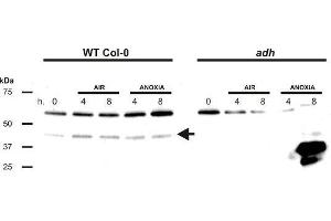 Western Blotting (WB) image for anti-Alcohol Dehydrogenase (ADH) antibody (ABIN7540305) (Alcohol Dehydrogenase (ADH) antibody)