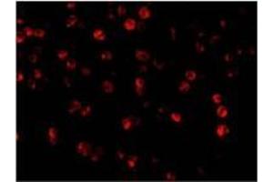 AP20057PU-N Beclin-1 antibody staining of A431 cells by Immunofluorescence at 2 μg/ml. (Beclin 1 antibody  (C-Term))