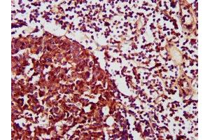 IHC image of ABIN7146103 diluted at 1:1200 and staining in paraffin-embedded human lymph node tissue performed on a Leica BondTM system.