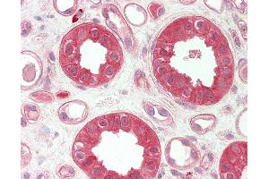 Human Kidney: Formalin-Fixed, Paraffin-Embedded (FFPE). (TMPRSS4 antibody  (AA 71-120))