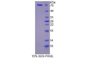 Image no. 1 for Tight Junction Protein 1 (TJP1) (AA 23-502) protein (His tag) (ABIN6237777)