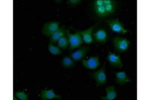 Immunofluorescence staining of A549 cells with ABIN7146877 at 1:50, counter-stained with DAPI. (CSNK1G3 antibody  (Isoform gamma 3))