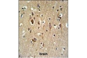 FA2H Antibody (Center) (ABIN650994 and ABIN2840028) IHC analysis in formalin fixed and paraffin embedded brain tissue followed by peroxidase conjugation of the secondary antibody and DAB staining. (FA2H antibody  (AA 121-148))