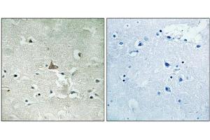 Immunohistochemical analysis of paraffin-embedded human brain tissue using Trk B (Phospho-Tyr706/Tyr707) antibody (left)or the same antibody preincubated with blocking peptide (right). (TRKB antibody  (pTyr706, pTyr707))