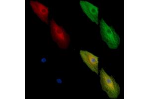 ABIN7096990 and ABIN7101057 staining  cells by IF/ICC.