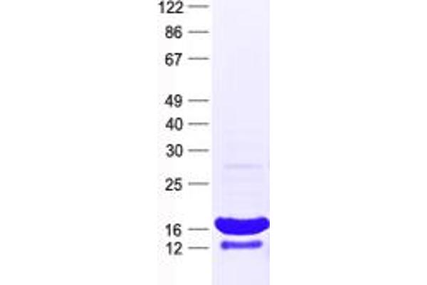 HIST1H2AG Protein (His tag)