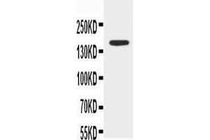 Western Blotting (WB) image for anti-ATP-Binding Cassette, Sub-Family B (MDR/TAP), Member 4 (ABCB4) (AA 1-20), (N-Term) antibody (ABIN3042908)