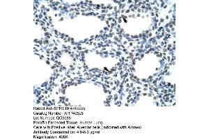 Rabbit Anti-SFRS10 Antibody  Paraffin Embedded Tissue: Human Lung Cellular Data: Alveolar cells Antibody Concentration: 4. (TRA2B antibody  (N-Term))