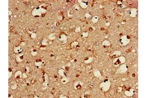 Immunohistochemistry of paraffin-embedded human brain tissue using ABIN7145729 at dilution of 1:100
