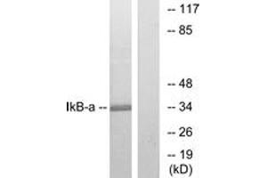 Western blot analysis of extracts from MCF7 cells, treated with TNF-alpha, using IkappaB-alpha (Ab-32/36) Antibody. (NFKBIA antibody  (AA 15-64))